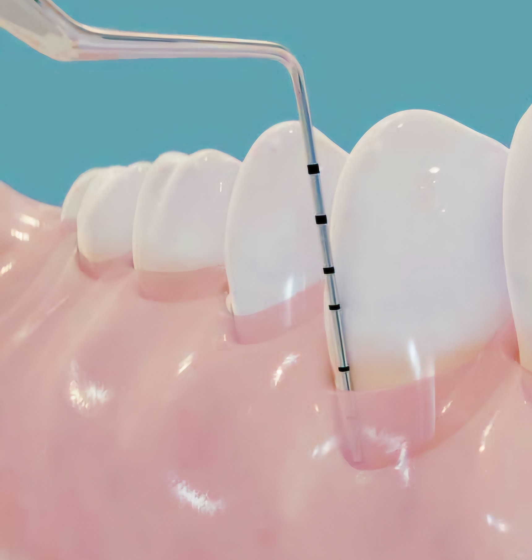 Gloss Dental Care,Best Dental Clinic in Vignan Nagar,Best Dental Care in Vignan Nagar,Best Dentist in Vignan Nagar,Best Root Canal Treatment in Vignan Nagar,Best Dentist near Vignan Nagar,Best Dental Clinic near Vignan Nagar,Best Dental Care near Vignan Nagar,Best Root Canal Treatment near Vignan Nagar,Dentist near me vignan nagar,Dental clinic near me vignan nagar,Dental clinic near me,Dentist near me,Dental Care near me,Bangalore.
