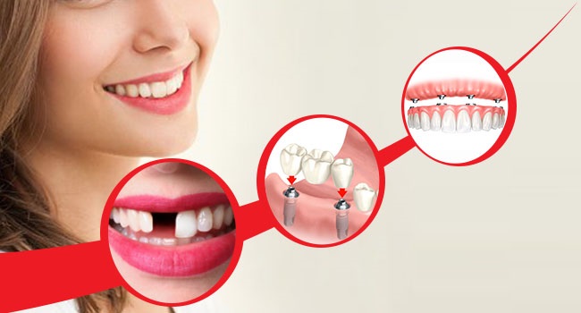Gloss Dental Care,Best Dental Clinic in Vignan Nagar,Best Dental Care in Vignan Nagar,Best Dentist in Vignan Nagar,Best Root Canal Treatment in Vignan Nagar,Best Dentist near Vignan Nagar,Best Dental Clinic near Vignan Nagar,Best Dental Care near Vignan Nagar,Best Root Canal Treatment near Vignan Nagar,Dentist near me vignan nagar,Dental clinic near me vignan nagar,Dental clinic near me,Dentist near me,Dental Care near me,Bangalore.