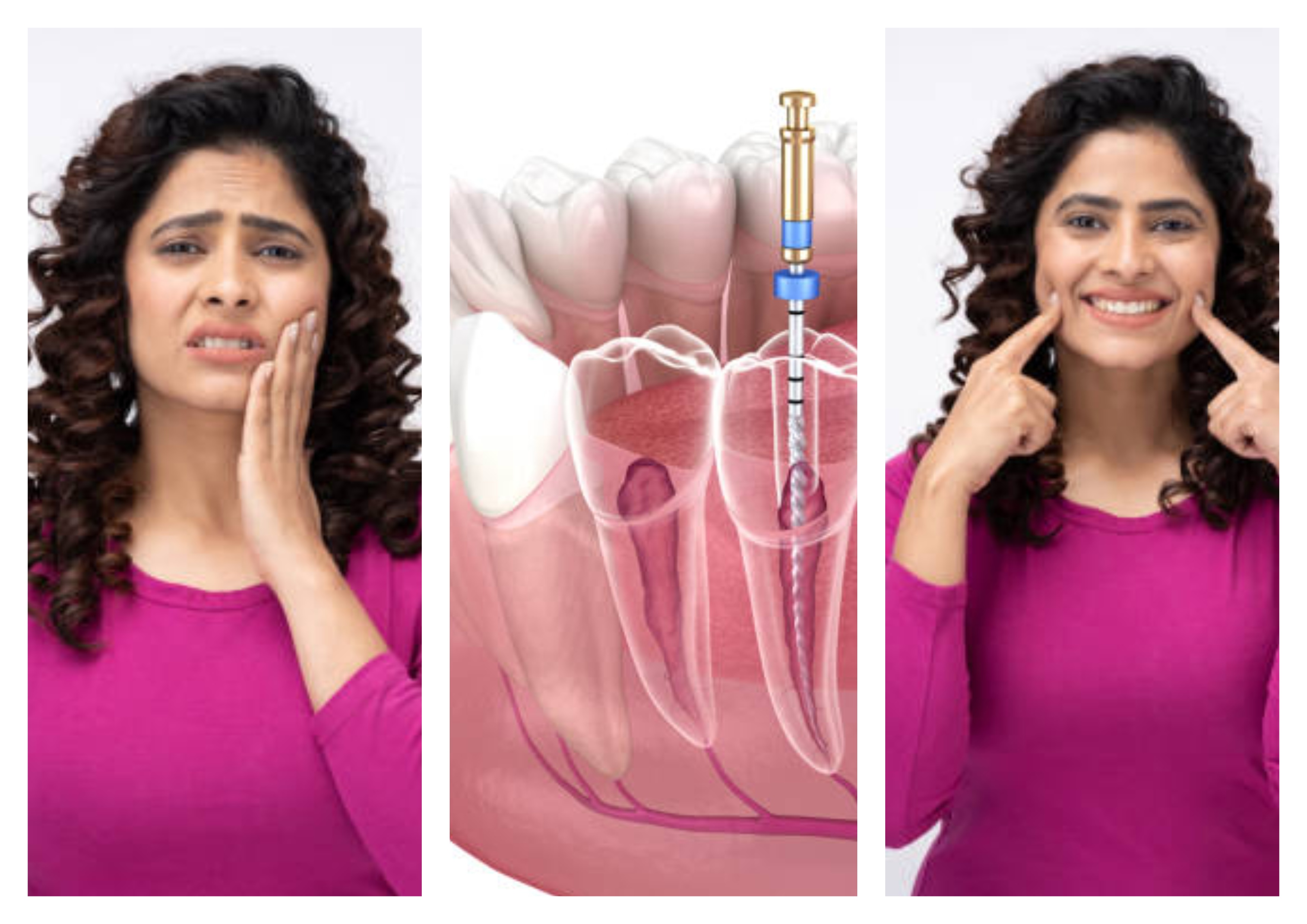 Gloss Dental Care,Best Dental Clinic in Vignan Nagar,Best Dental Care in Vignan Nagar,Best Dentist in Vignan Nagar,Best Root Canal Treatment in Vignan Nagar,Best Dentist near Vignan Nagar,Best Dental Clinic near Vignan Nagar,Best Dental Care near Vignan Nagar,Best Root Canal Treatment near Vignan Nagar,Dentist near me vignan nagar,Dental clinic near me vignan nagar,Dental clinic near me,Dentist near me,Dental Care near me,Bangalore.