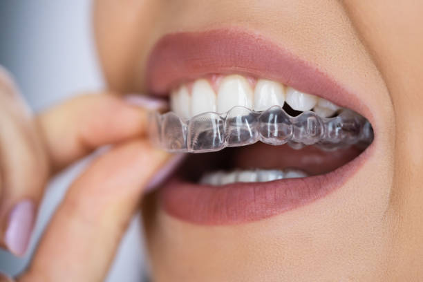 Gloss Dental Care,Best Dental Clinic in Vignan Nagar,Best Dental Care in Vignan Nagar,Best Dentist in Vignan Nagar,Best Root Canal Treatment in Vignan Nagar,Best Dentist near Vignan Nagar,Best Dental Clinic near Vignan Nagar,Best Dental Care near Vignan Nagar,Best Root Canal Treatment near Vignan Nagar,Dentist near me vignan nagar,Dental clinic near me vignan nagar,Dental clinic near me,Dentist near me,Dental Care near me,Bangalore.